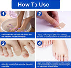 Nail Repair Patches