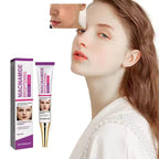 Lightening Melasma Cream