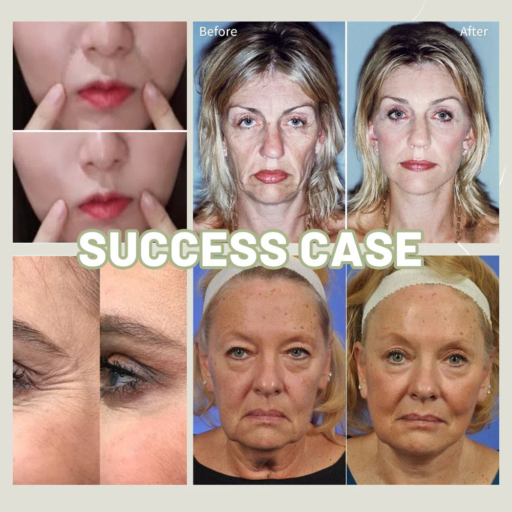 Wrinkle Remover serum