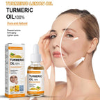 Turmeric Whitening Freckles